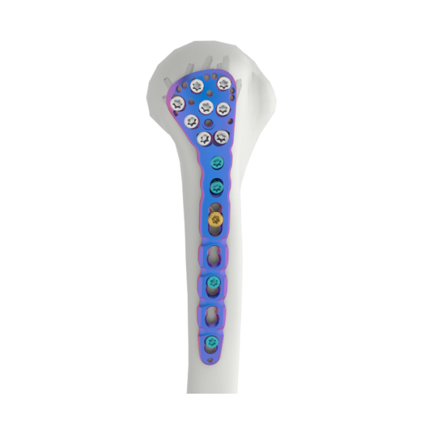 PLAT Penguncian Humeral Proksimal VAL