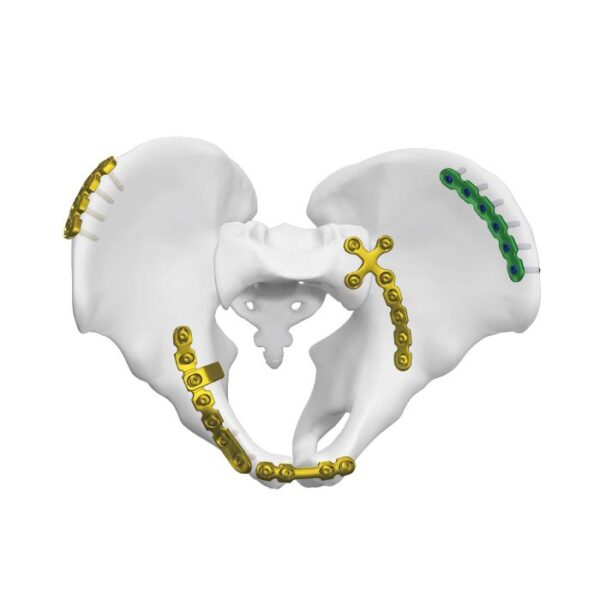 Pelat Sendi Sakroiliaka Anterior