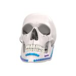 Sistem Fiksasi Mandibula