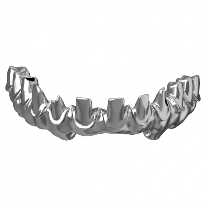 Jembatan Implan Titanium