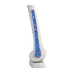 VAL Plat Pengunci Femur Distal
