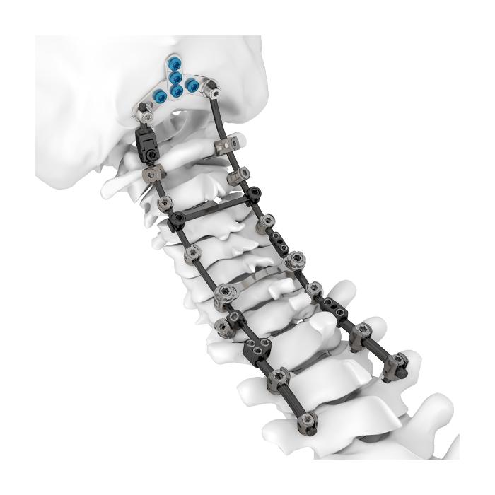 Sistem HOBBIT Serviks Posterior Spine 3.5/4.0