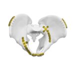 Pelat Kuadrangulare Permukaan Posterior
