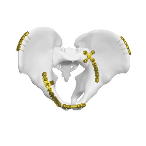 Pelat Kuadrangulare Permukaan Posterior